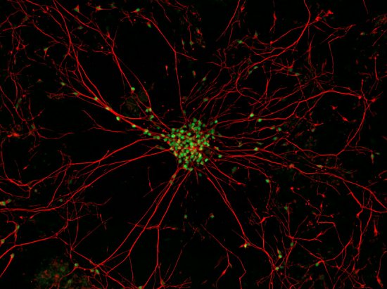最佳年度生物显微照片,水蚤微观照居首