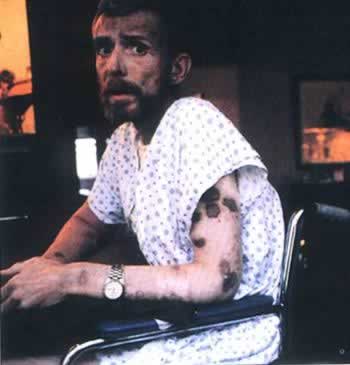 世界卫生组织宣布每年12月1日为“世界艾滋病日”(歷史上的今天.中國)