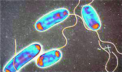 英格兰发现军团病